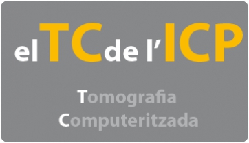El nou equipament de tomografia computeritzada ja és a l’ICP